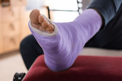 Foot Fractures treatment in the Pearland, TX 77584 and Houston, TX 77027, 77074, 77008 areas