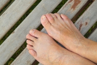 What Can Cause Hammertoes?