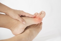 Causes and Symptoms of a Bunion