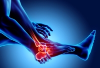 Understanding What Arthritis in the Feet Feels Like