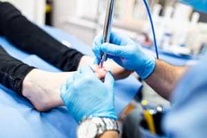 Why Laser Therapy Is Effective in Treating Toenail Fungus