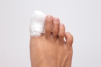 Helping Broken Toes Heal at Home