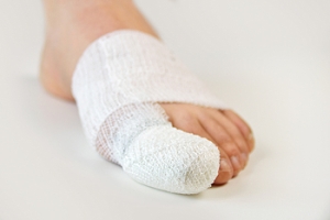 Turf Toe Severities